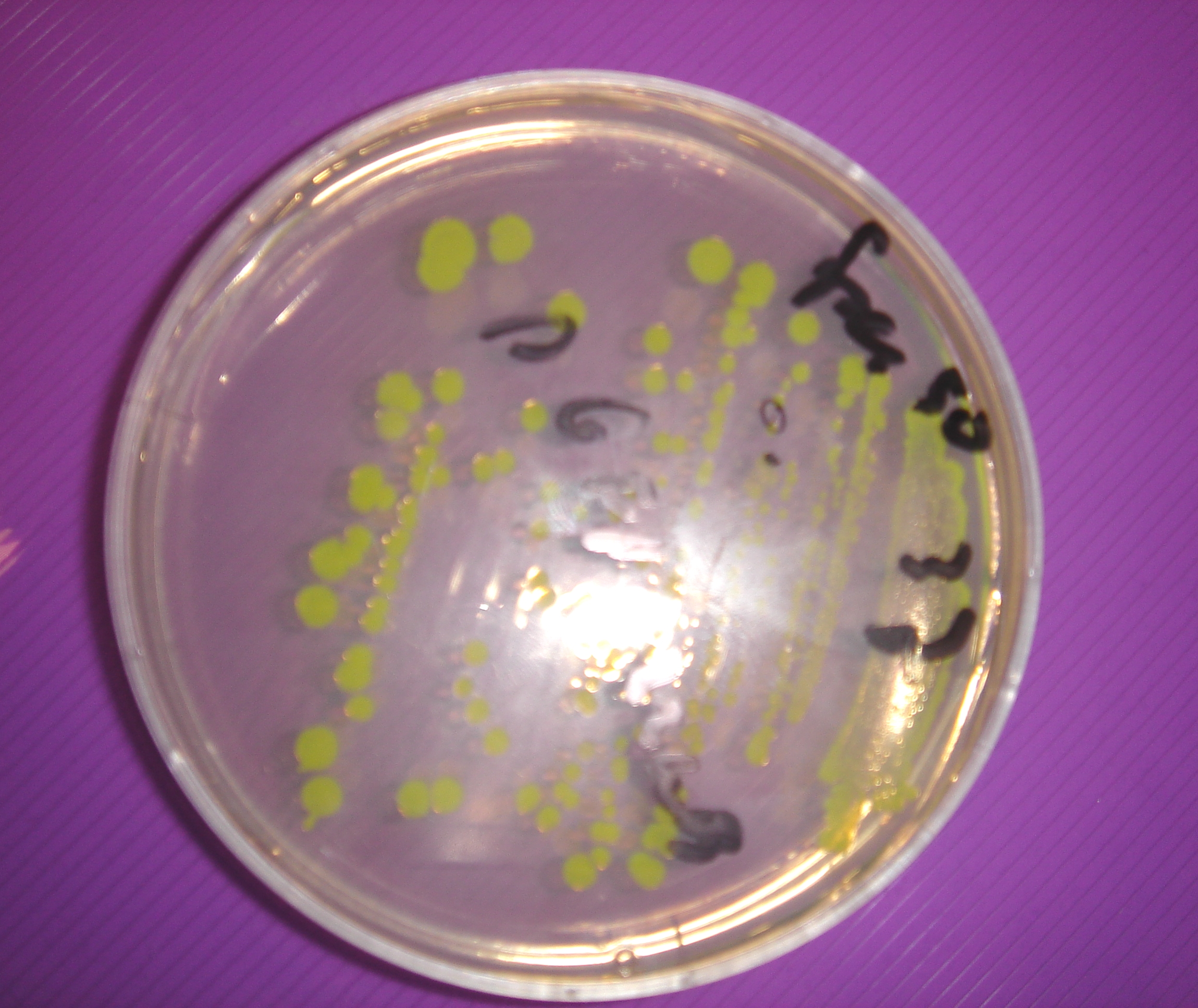 pGFP-rrnB colonies on +Spec agar plate