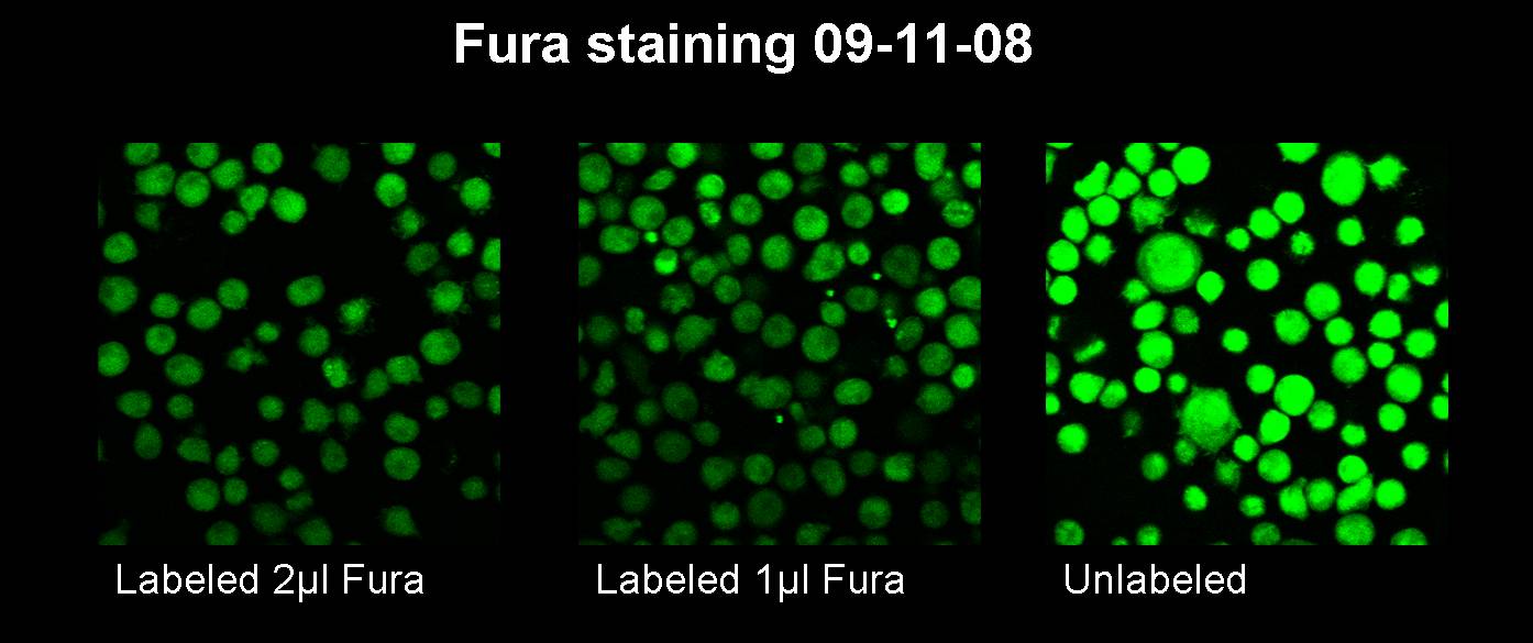 11.09.08 Test Fura staining-Freigem08.jpg