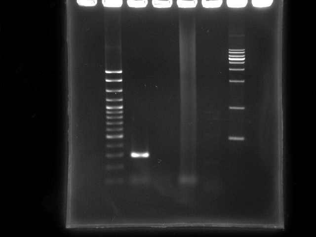 NYMU 20080903 ppk pst PCR.JPG