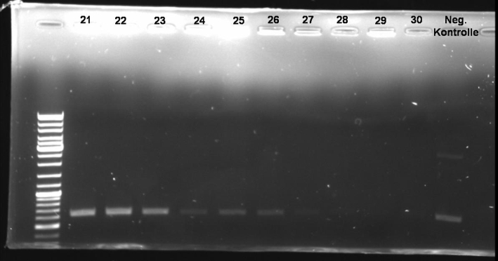 080929 colony PCR Screen for colE9 His small.jpg
