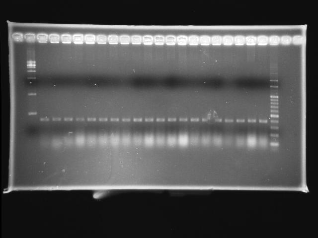 NYMU 20081001 colony PCR pLac P0440.jpg