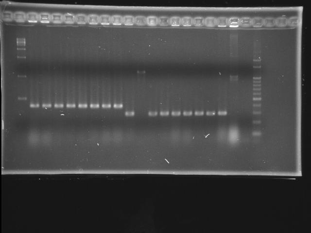 NYMU 20080926 colony PCR.jpg