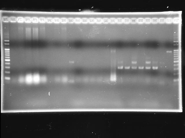 NYMU 20080920 P0440 J04430 I763004 colony PCR.jpg