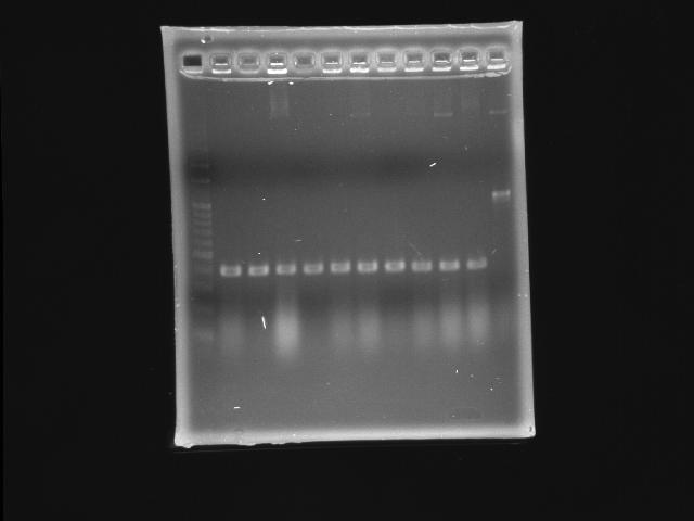 NYMU 20080927 colony PCR pLac P0440.jpg