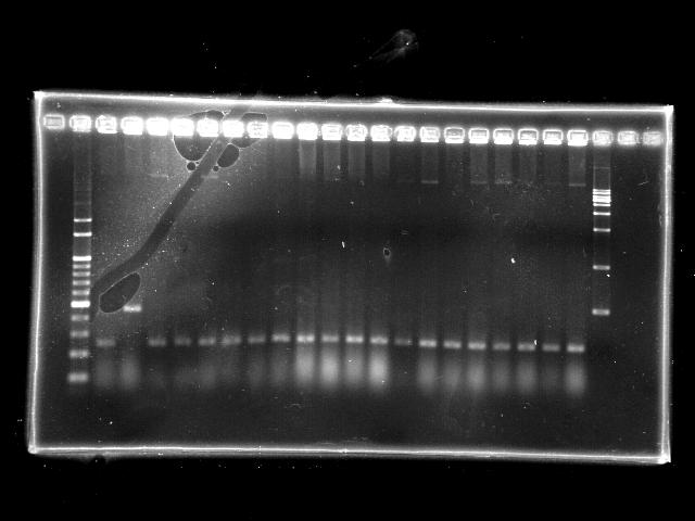 NYMU 20081001 colony PCR RBS PPK.jpg