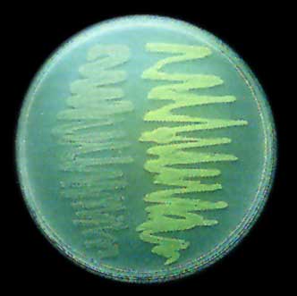 E.coli transformed with GFP plasmid.