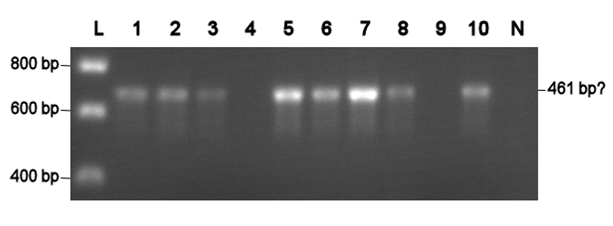 BCCS-080804 colony pcr BBa J63002 labeled.png